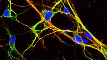Некоторые некодирующие РНК помогают регулировать функцию нервных клеток